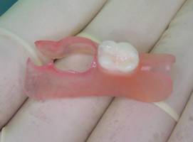 Нейлоновый протез